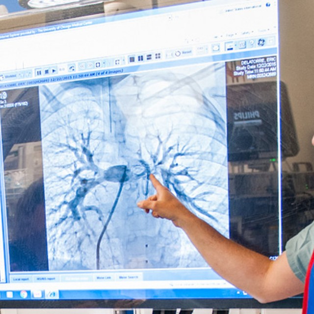 Cardiology faculty points to lung imaging