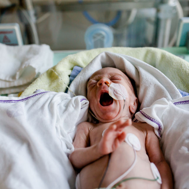 Premature infant yawning