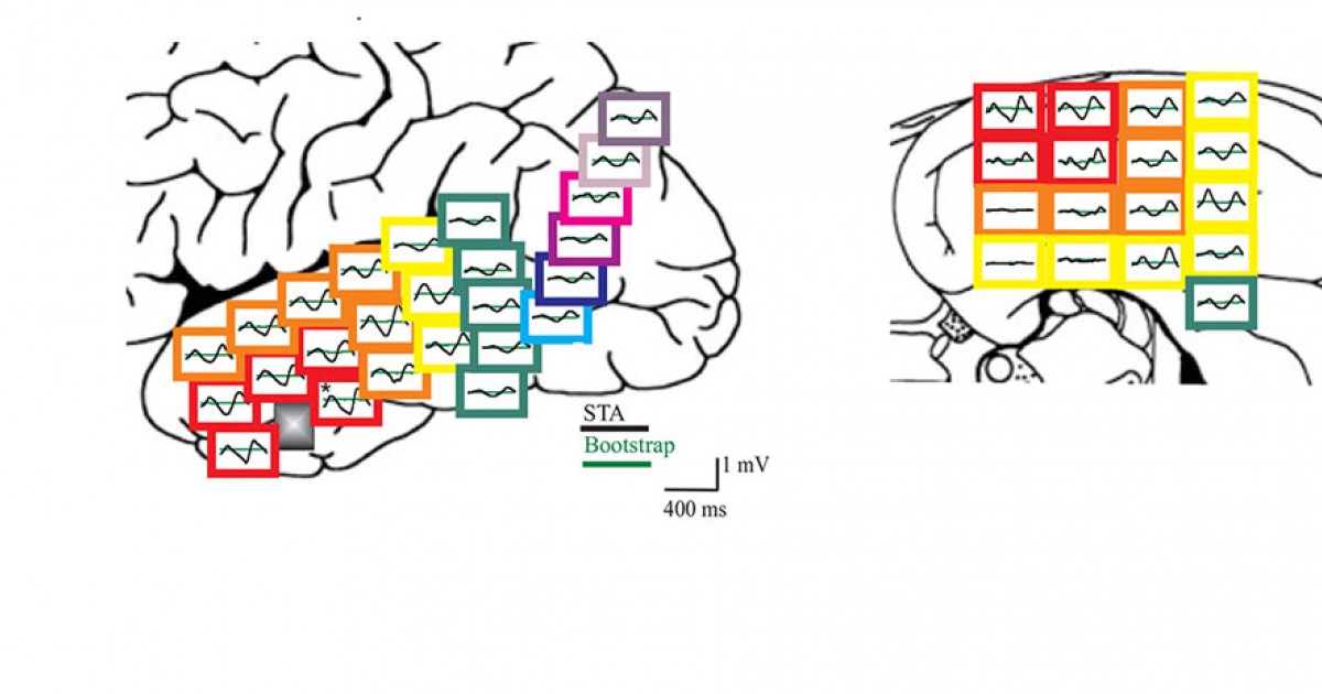 Child Neurology Residency Department of Pediatrics The University